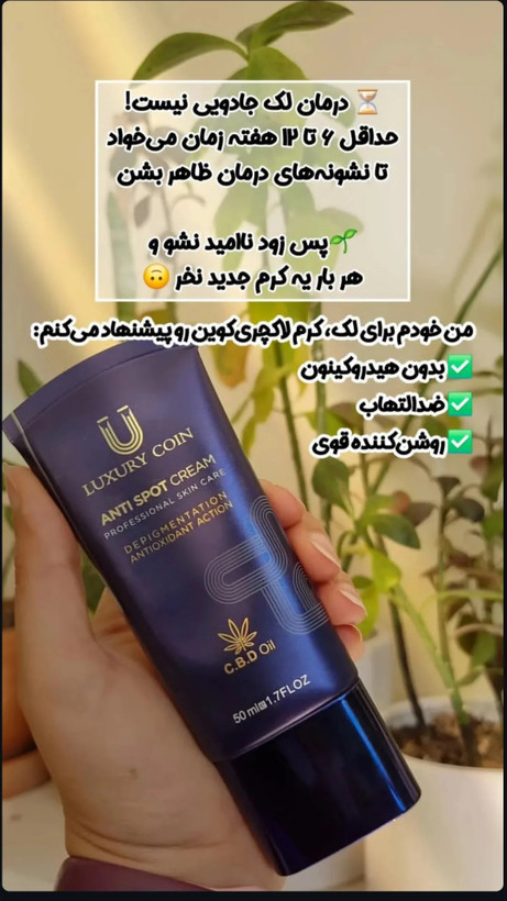 ضد لک ۸کاره فرانسوی الفاآربوتین لاکچری کوین