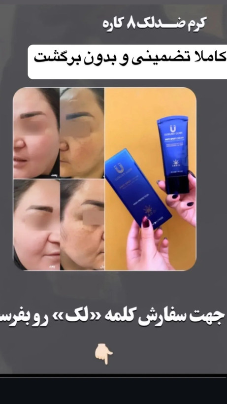ضد لک ۸کاره فرانسوی الفاآربوتین لاکچری کوین